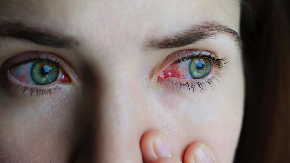 More Eye Diseases