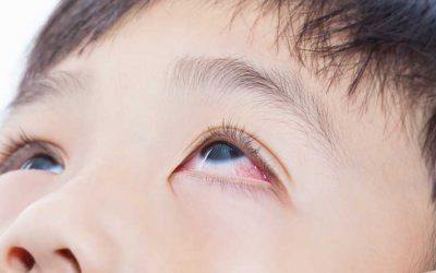 Why We Get Eye Diseases